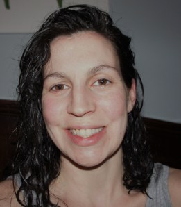 I took this picture to document my skin condition and overall appearance before I start the Oil Routine